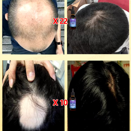 HIGH QUALITY HAIR GROWTH SERUM 98% customar buy again and again