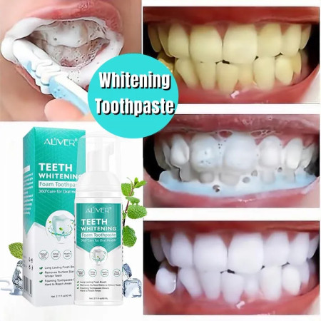 Teeth Whitening Mousse Toothpaste