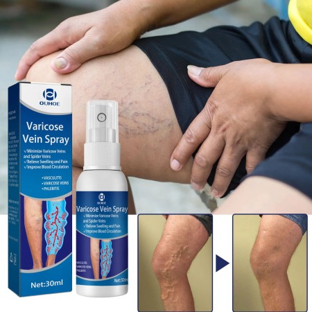 MAN/LADES【OUHOE】Varicose Veins Spayer